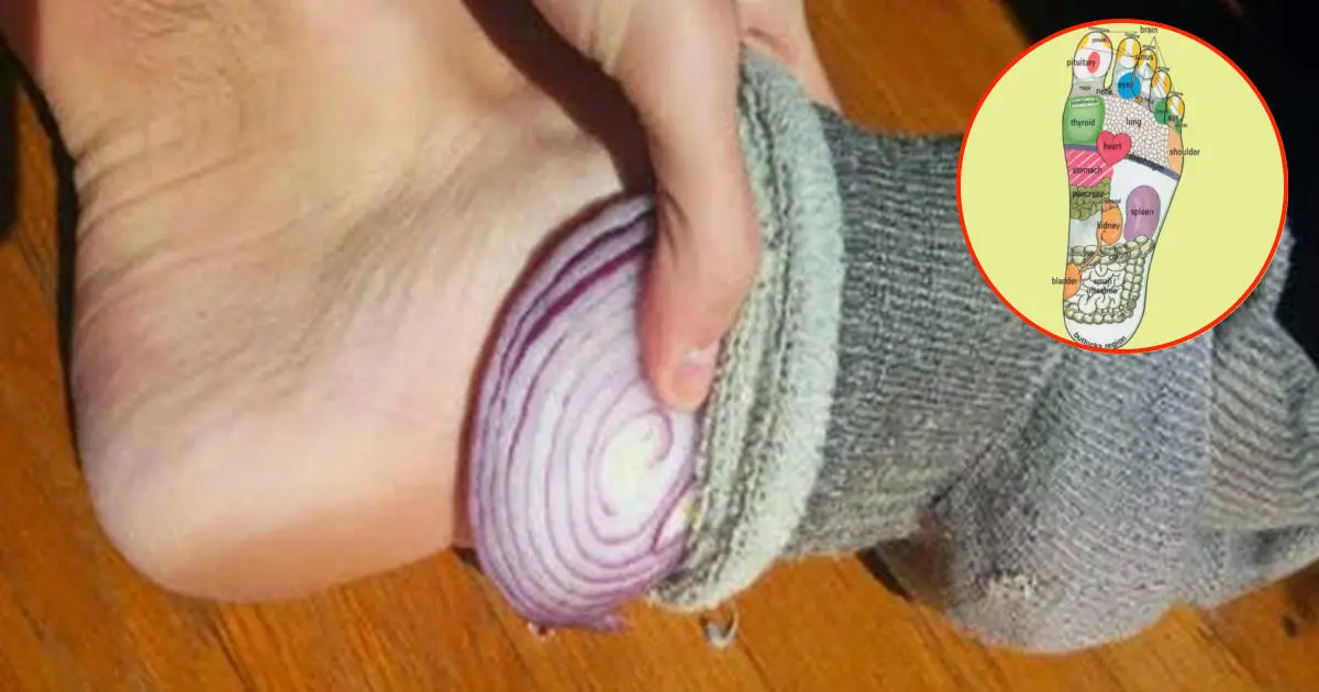 آیا درمان خار پاشنه با پیاز واقعا موثر است؟ درمان خار پاشنه با پیاز