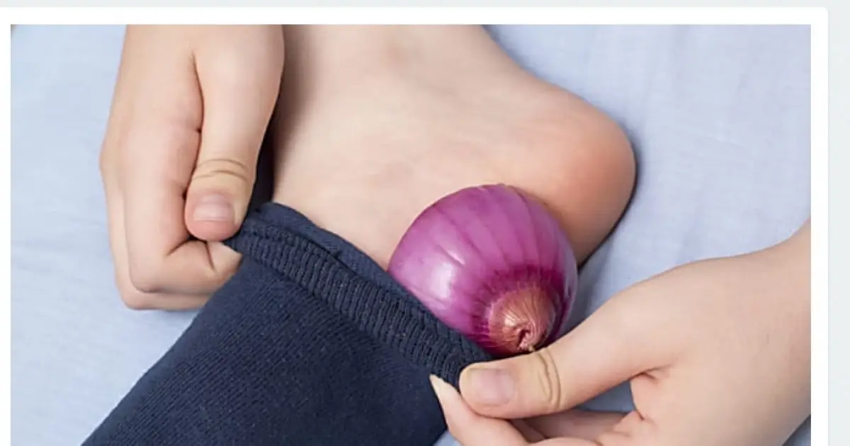 آیا درمان خار پاشنه با پیاز واقعا موثر است؟ درمان خار پاشنه با پیاز